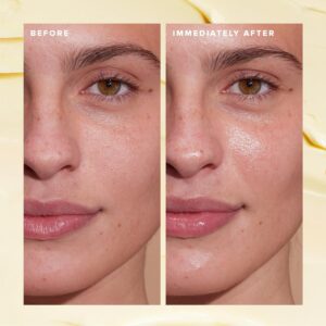 Before Photo: “Close-up of bare skin with visible acne spots and uneven texture.” After Photo: “Close-up of clear, radiant skin after consistent skincare routine.”